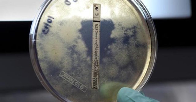 Los científicos extreman sus esfuerzos para detener el brote de meningitis micótica