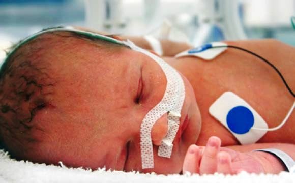 Cinco medidas podrían bajar la tasa de bebés prematuros 