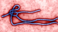 Unos padres hacen creer a su hijo que está enfermo de ébola