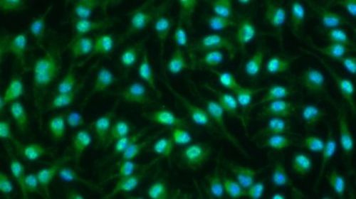 Marcadores inflamatorios (en verde) en el núcleo de los macrófagos (en azul)./IRB Barcelona