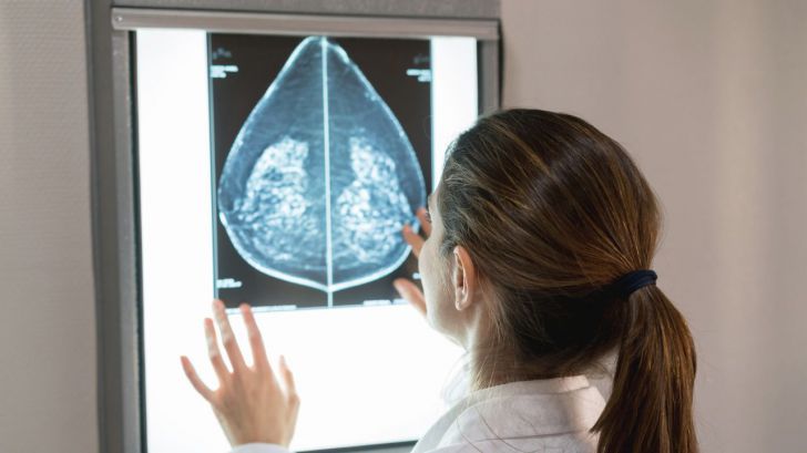 Descubre cómo este nuevo predictor genético puede salvar vidas en pacientes con cáncer de mama