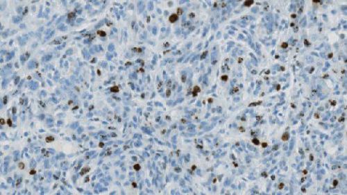 La duración del ciclo celular podría predecir el riesgo de cáncer