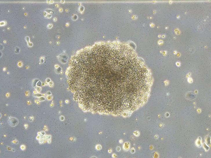 Investigadores del CSIC descubren un nuevo mecanismo que afecta la quimioterapia