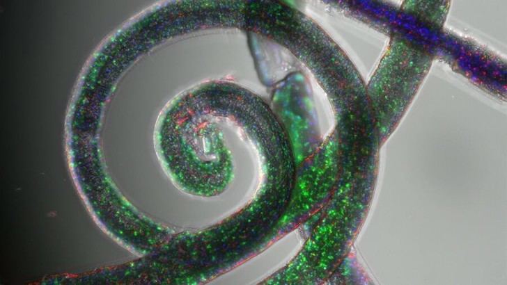 Desarrollan modelos 3D de cáncer en hidrogel que simulan condiciones reales de tumores