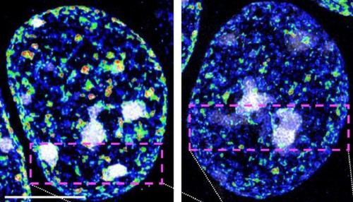 Descubren enzimas que mantienen la identidad de las neuronas