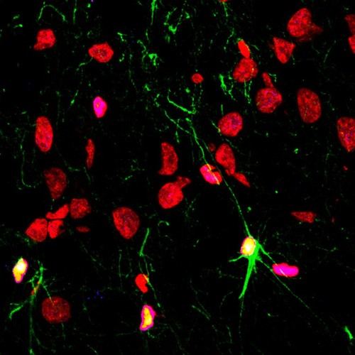 El consumo de alcohol y drogas, junto a enfermedades psiquiátricas, afecta la creación de nuevas neuronas en el cerebro