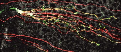 Nueva molécula activada por luz promete aliviar el dolor ocular en casos de ojo seco