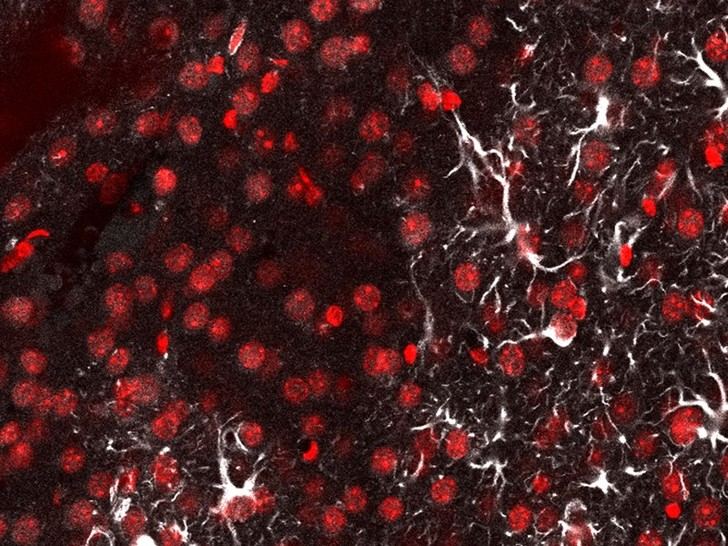 Desarrollan una sonda de luz ultrafina para detectar metástasis cerebral en ratones