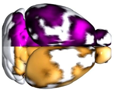 Detectan microtrombos en el cerebro de pacientes con Alzheimer mediante nueva técnica de imagen