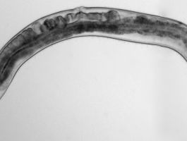 El gusano 'Caenorhabditis elegans' emerge como una herramienta esencial para elaborar futuras terapias.